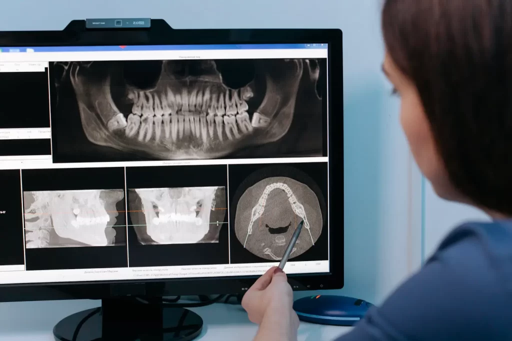 dental x-rays - Dentist in Northridge
