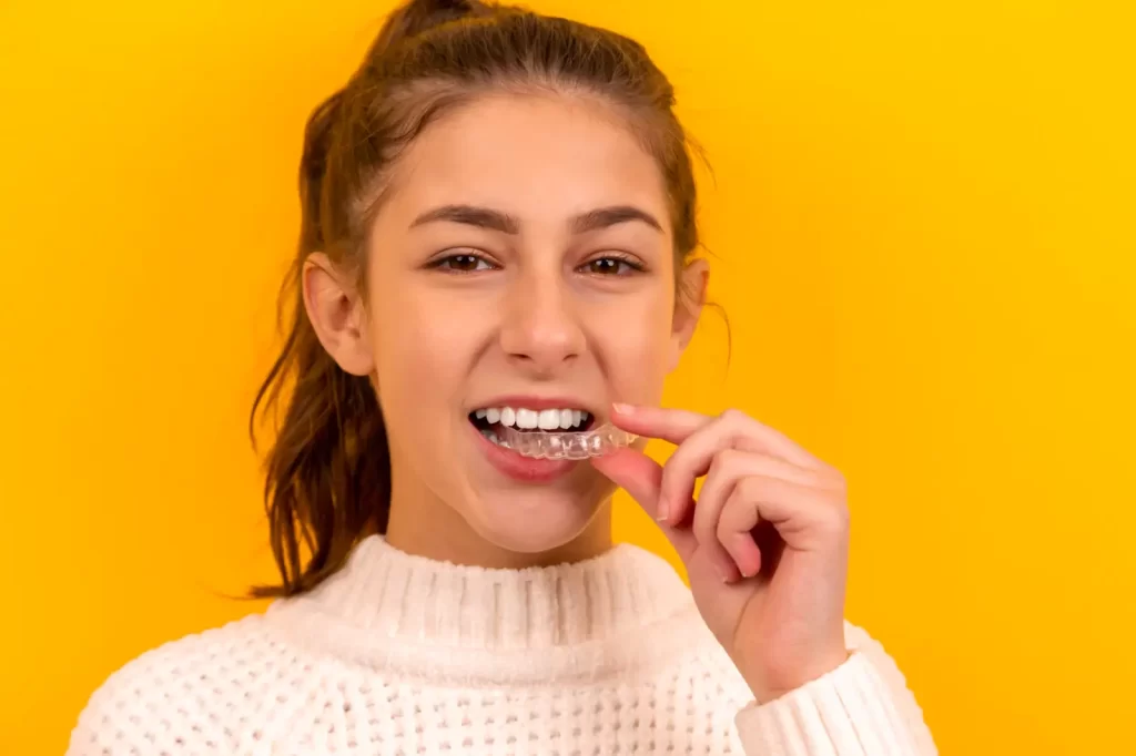 mouth guards