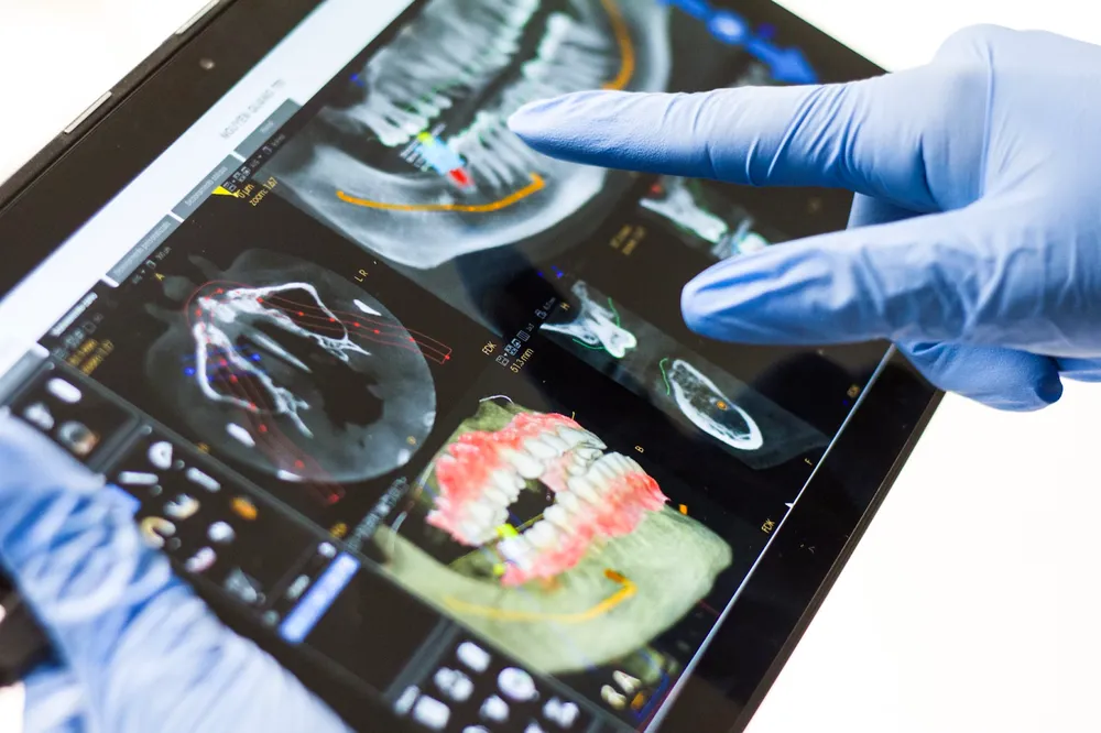 Dental x-rays