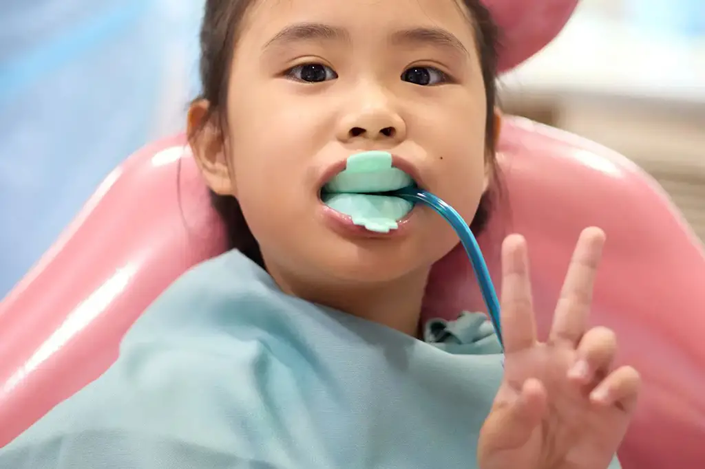 fluoride treatments