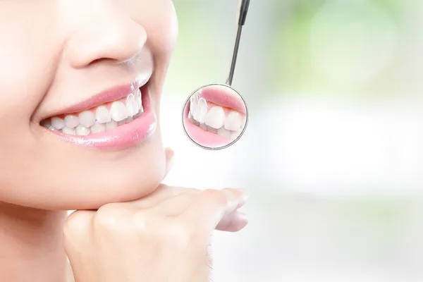 bright white smile
