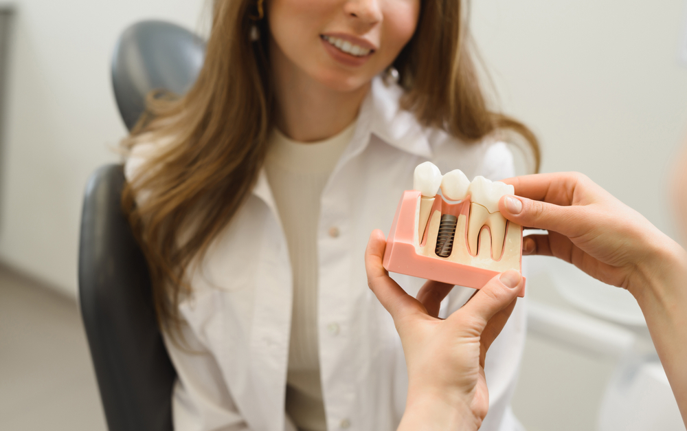 dental implants in Northridge
