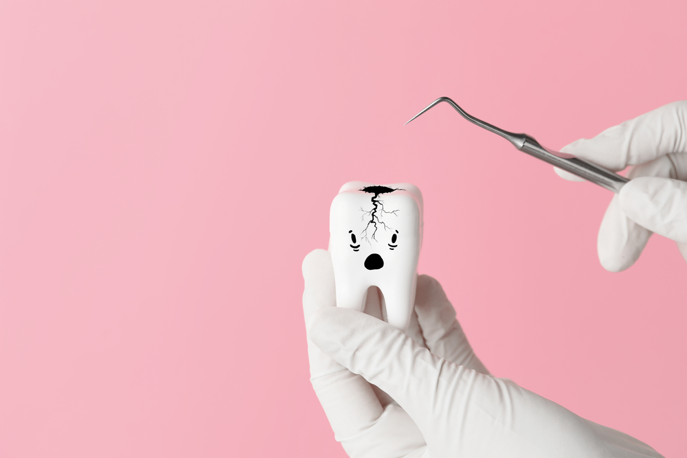 Cracked tooth