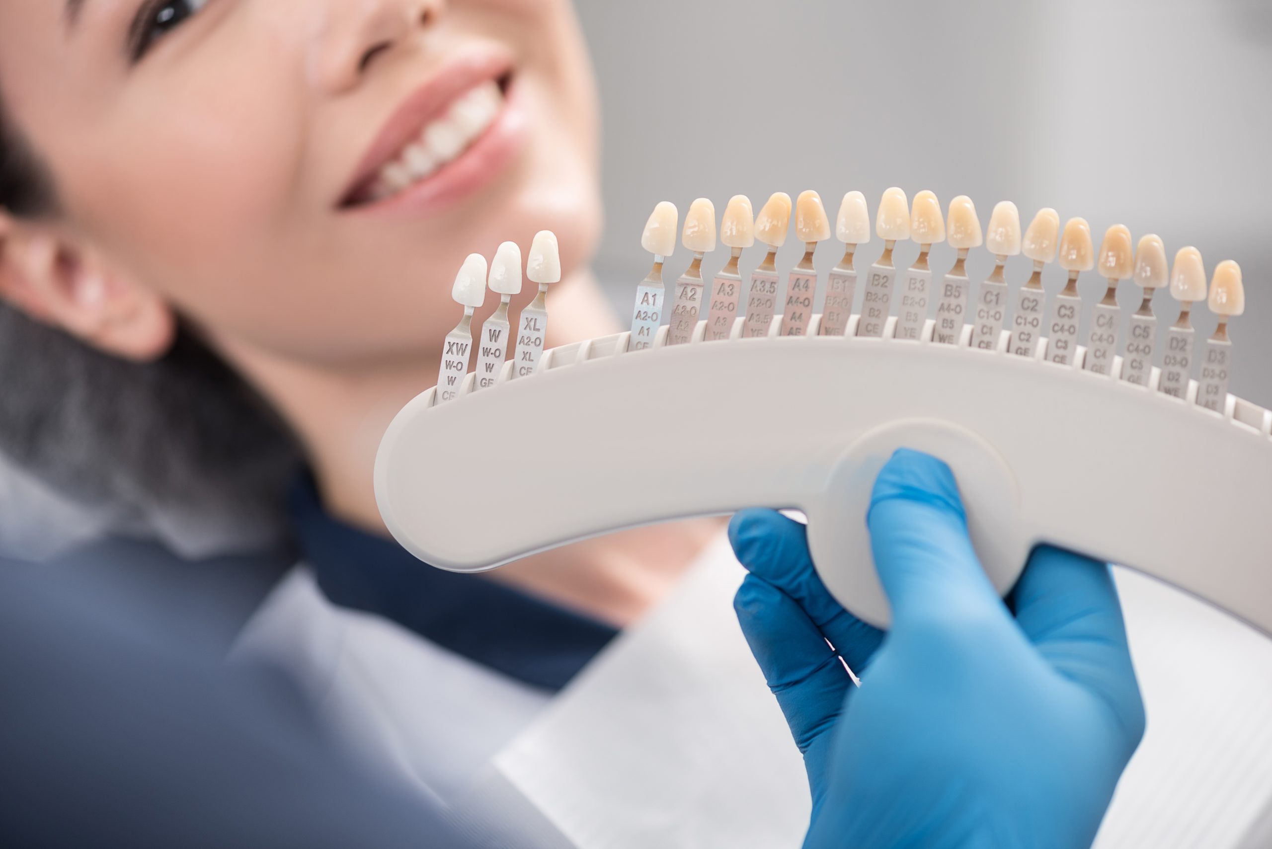 porcelain veneers